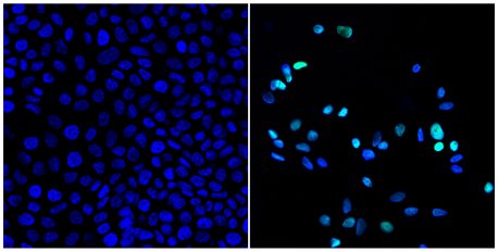At left, tumor cells shown before treatment with a drug to activate the circadian clock. At right, a greatly reduced number of tumor cells after drug treatment. Green color at right indicates dying cells. 
